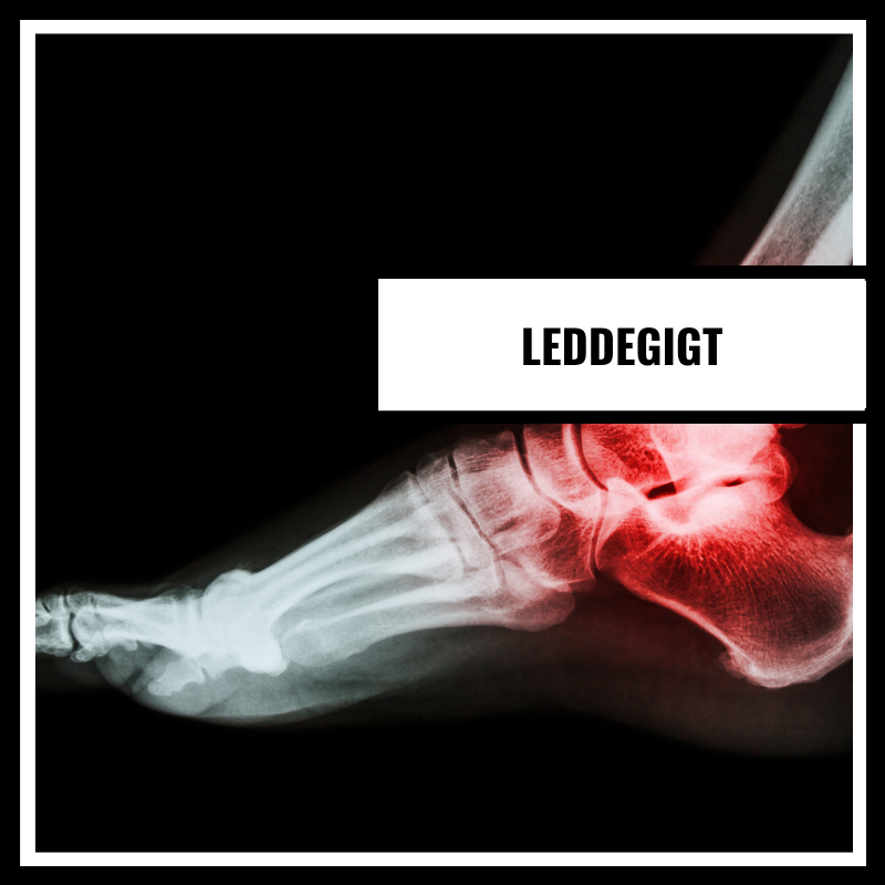 Ledgångsreumatism