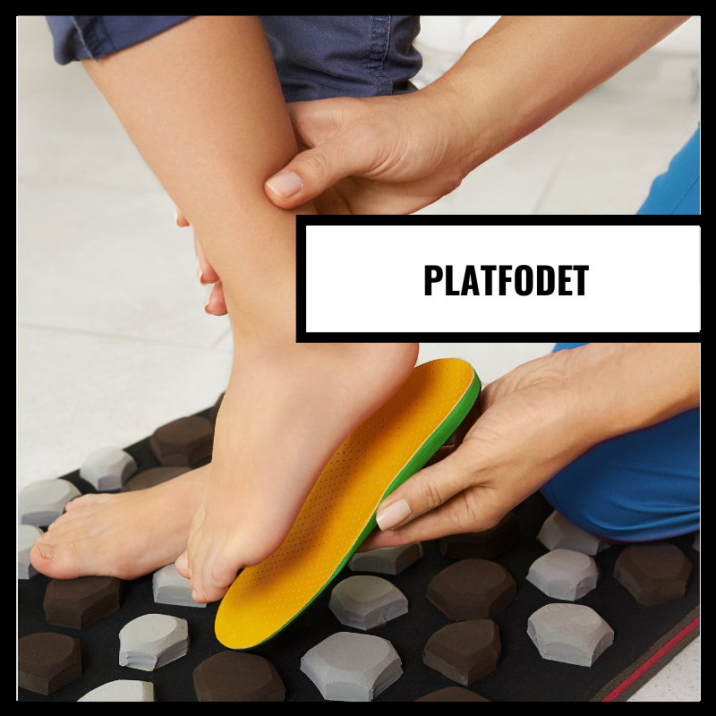 Platta fötter