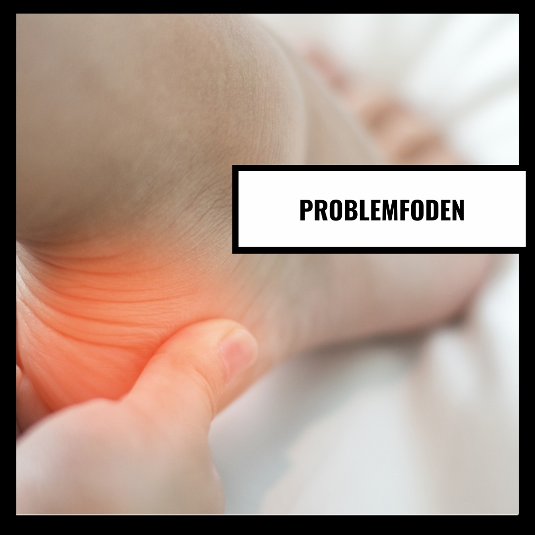 Problemfoten