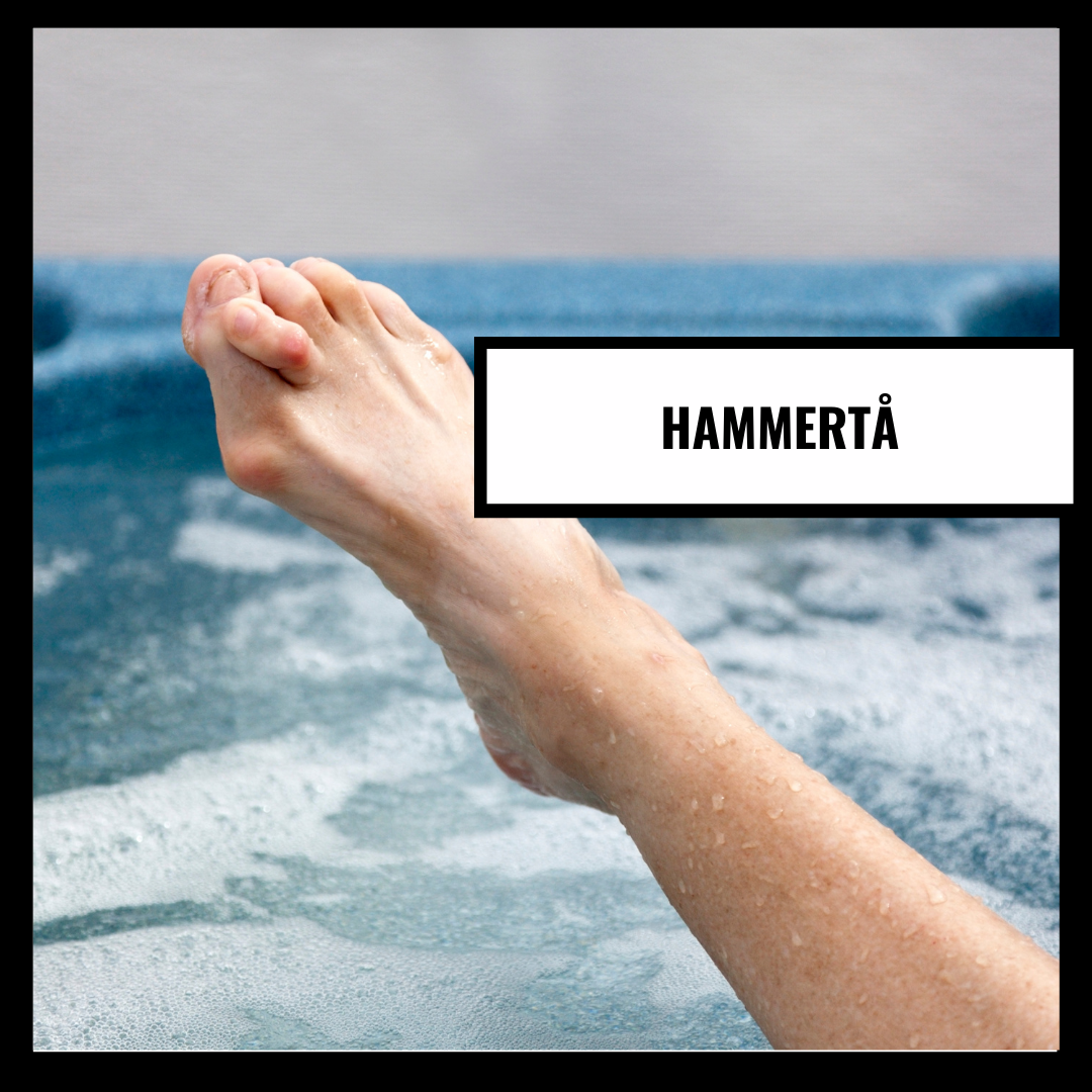 Hammertå