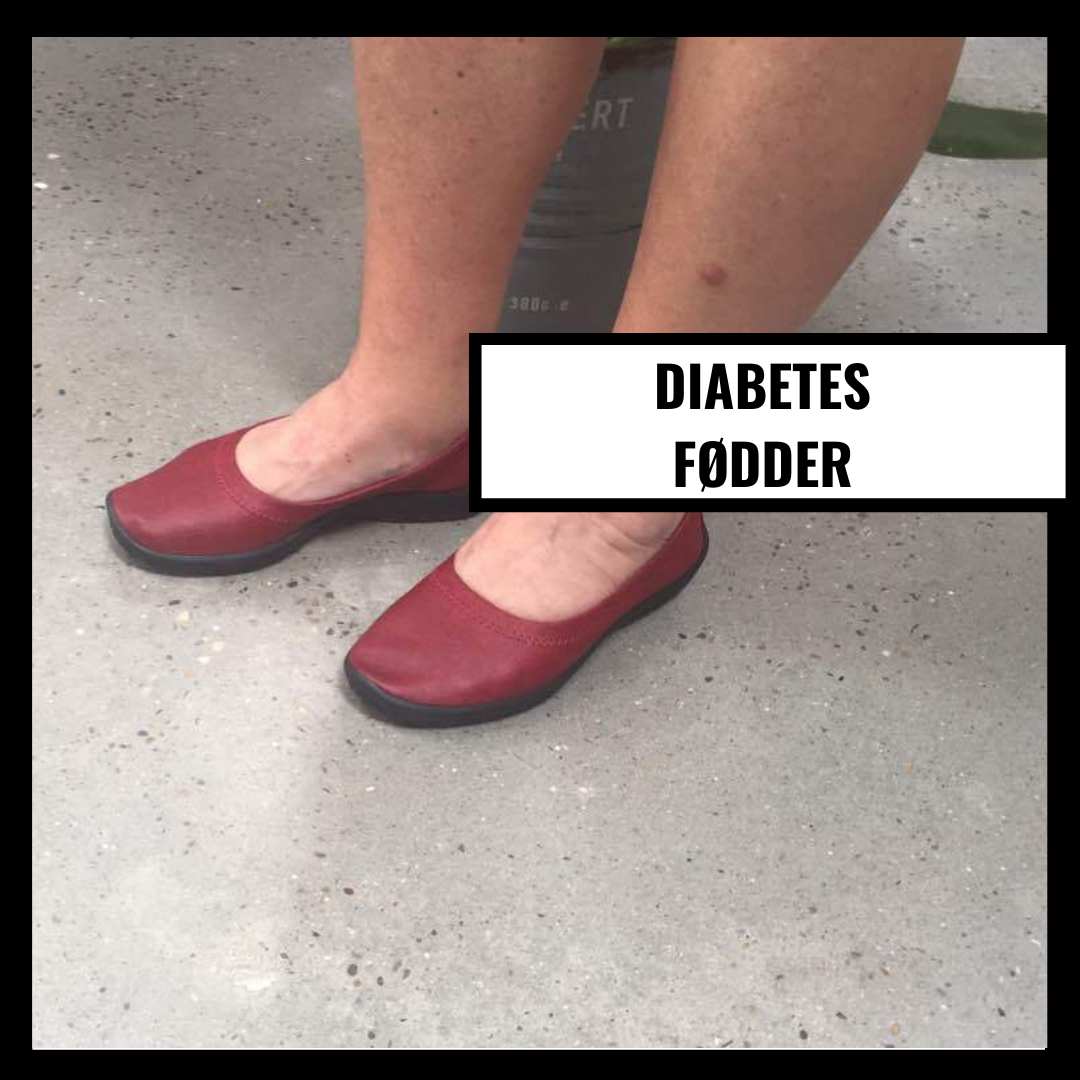 Diabetesfötter